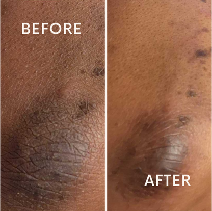 Turmeric Dark Spot Soap